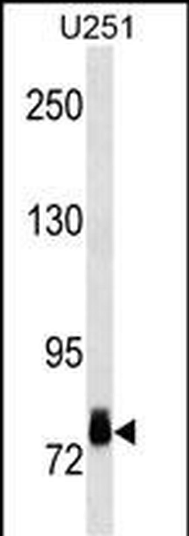 RSK2 Antibody in Western Blot (WB)