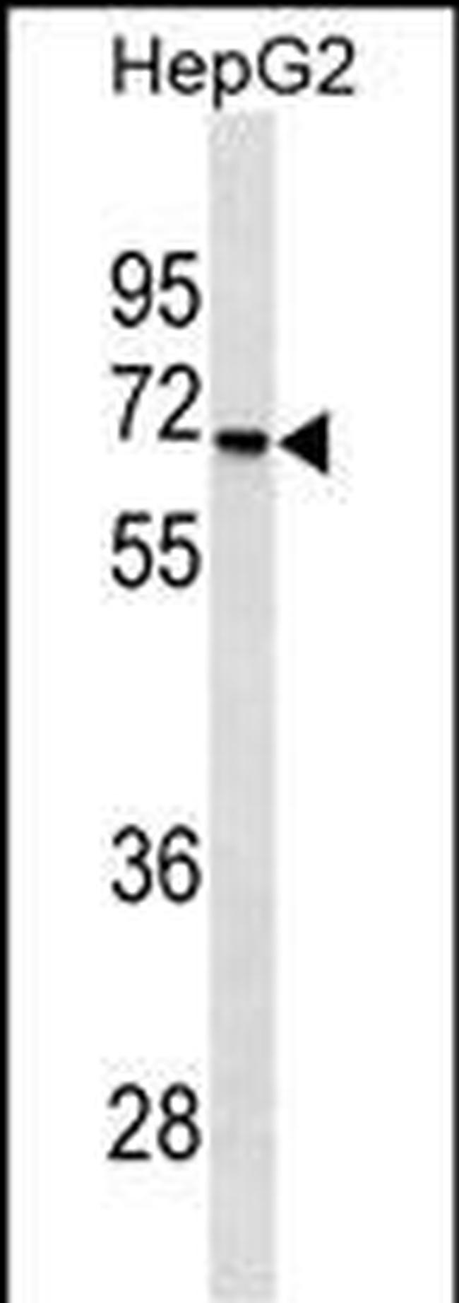 STK39 Antibody in Western Blot (WB)