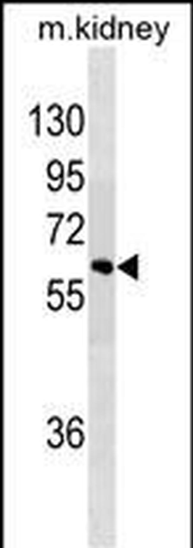 SPRED1 Antibody in Western Blot (WB)