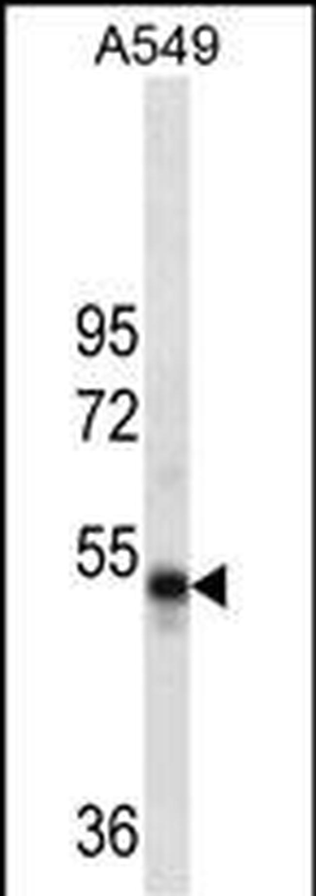 RUVBL1 Antibody in Western Blot (WB)