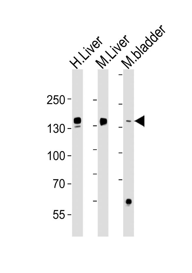 Fibrinogen alpha chain Antibody in Western Blot (WB)