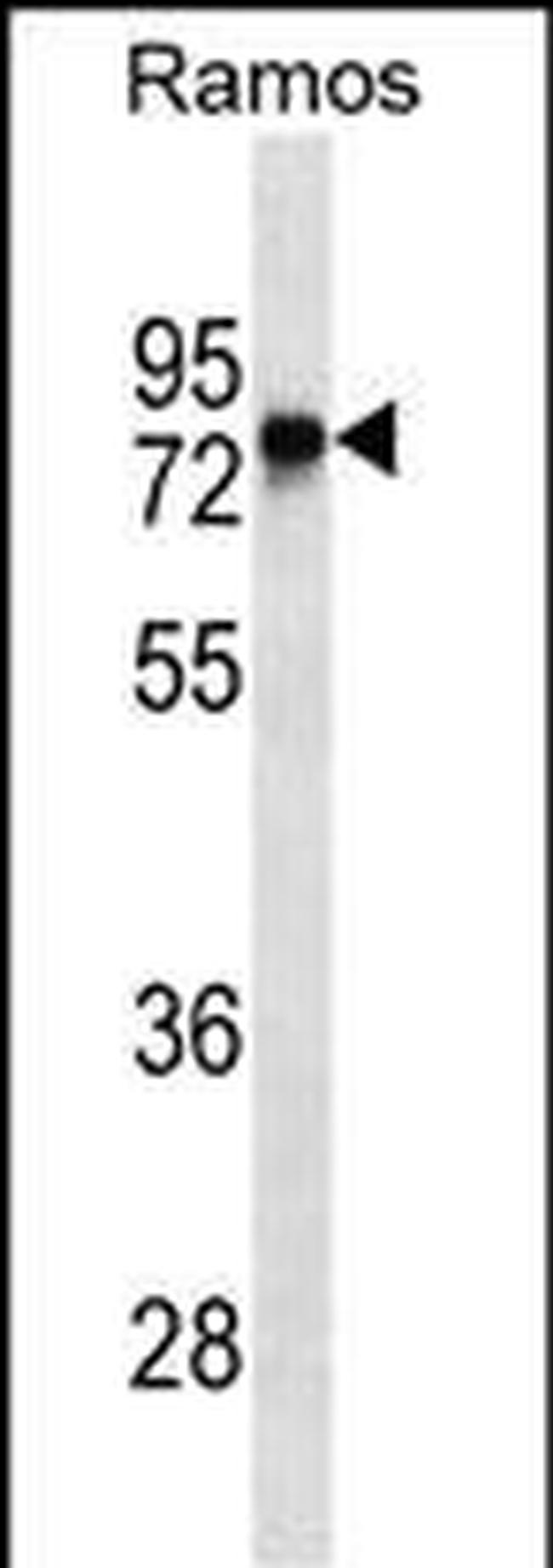 Btk Antibody in Western Blot (WB)