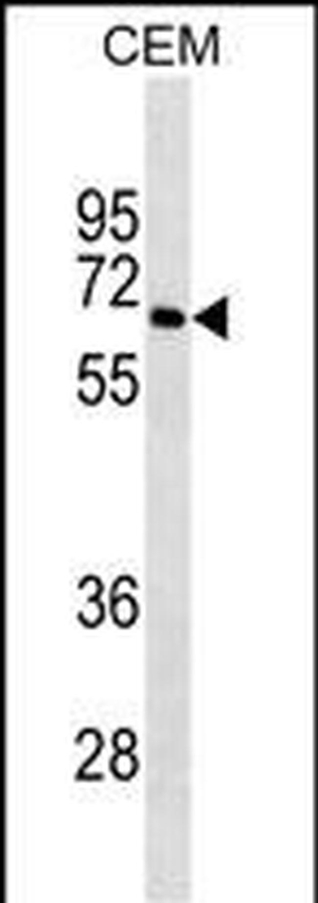 BLNK Antibody in Western Blot (WB)