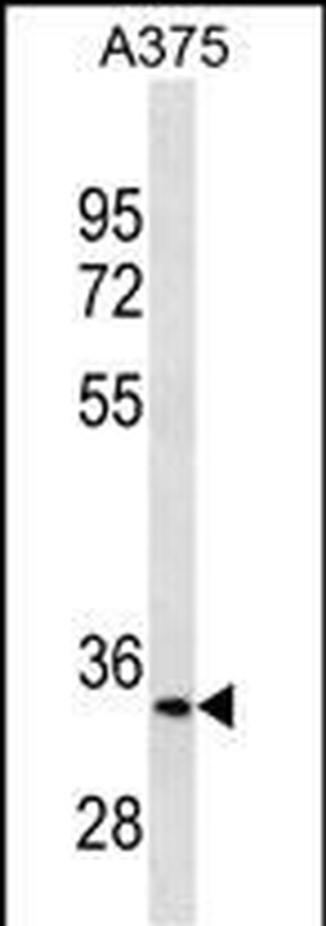 MC1R Antibody in Western Blot (WB)