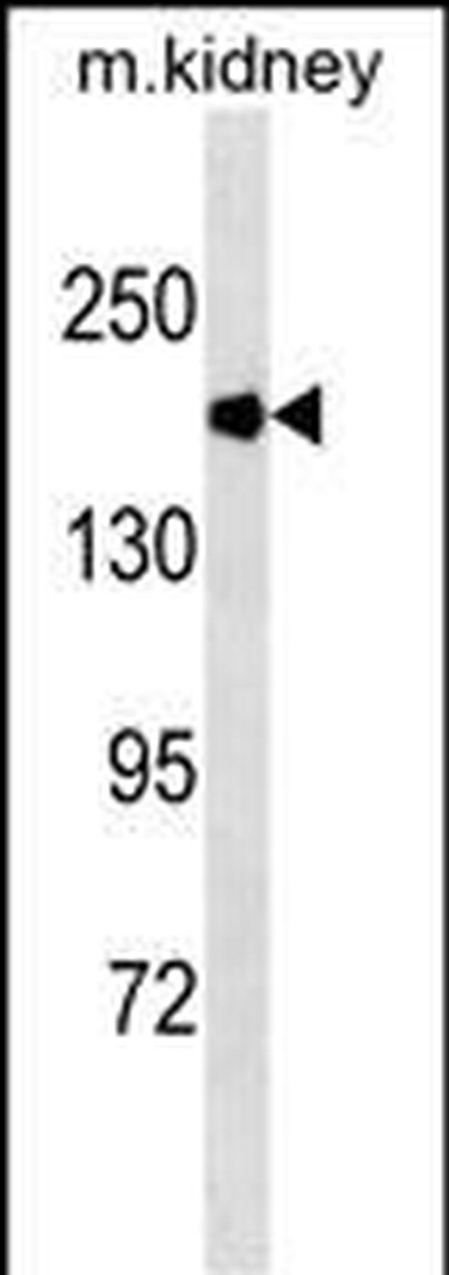 ACE Antibody in Western Blot (WB)