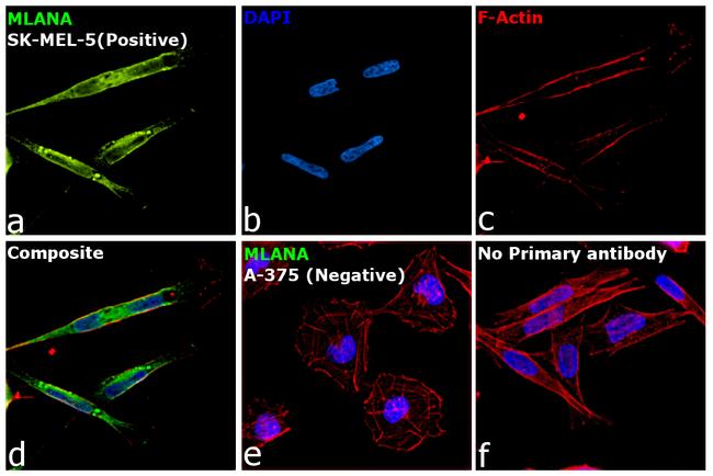 Melan-A Antibody in Immunocytochemistry (ICC/IF)