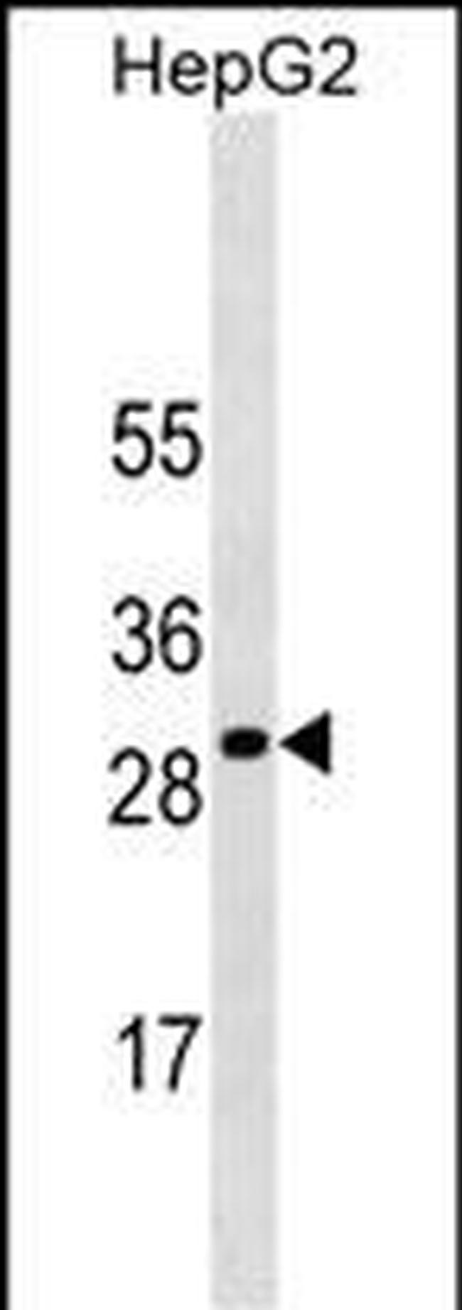 SOCS3 Antibody in Western Blot (WB)