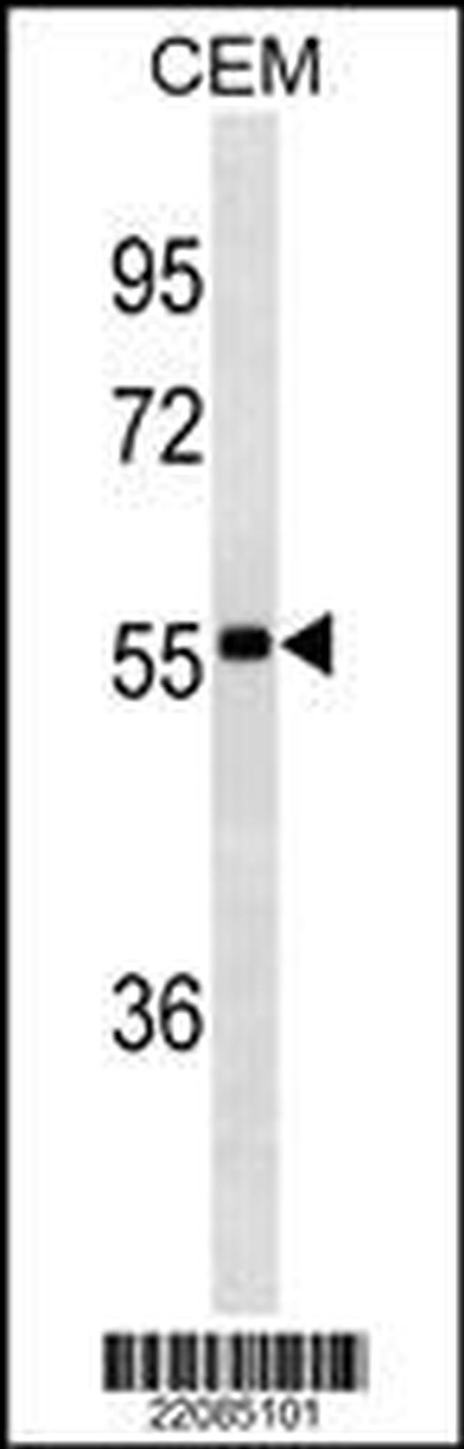 IGHA1 Antibody in Western Blot (WB)