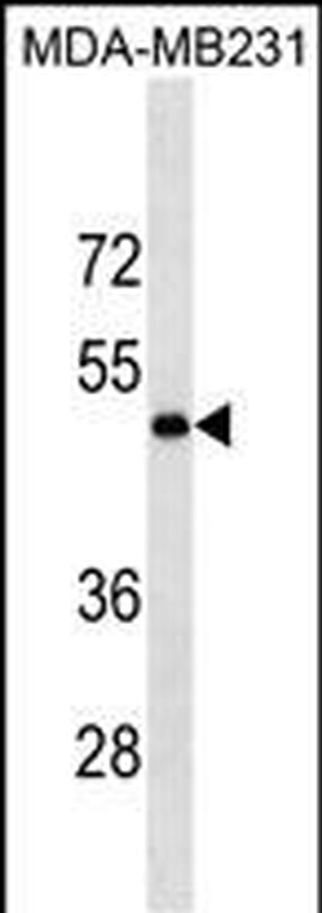 LOX Antibody in Western Blot (WB)