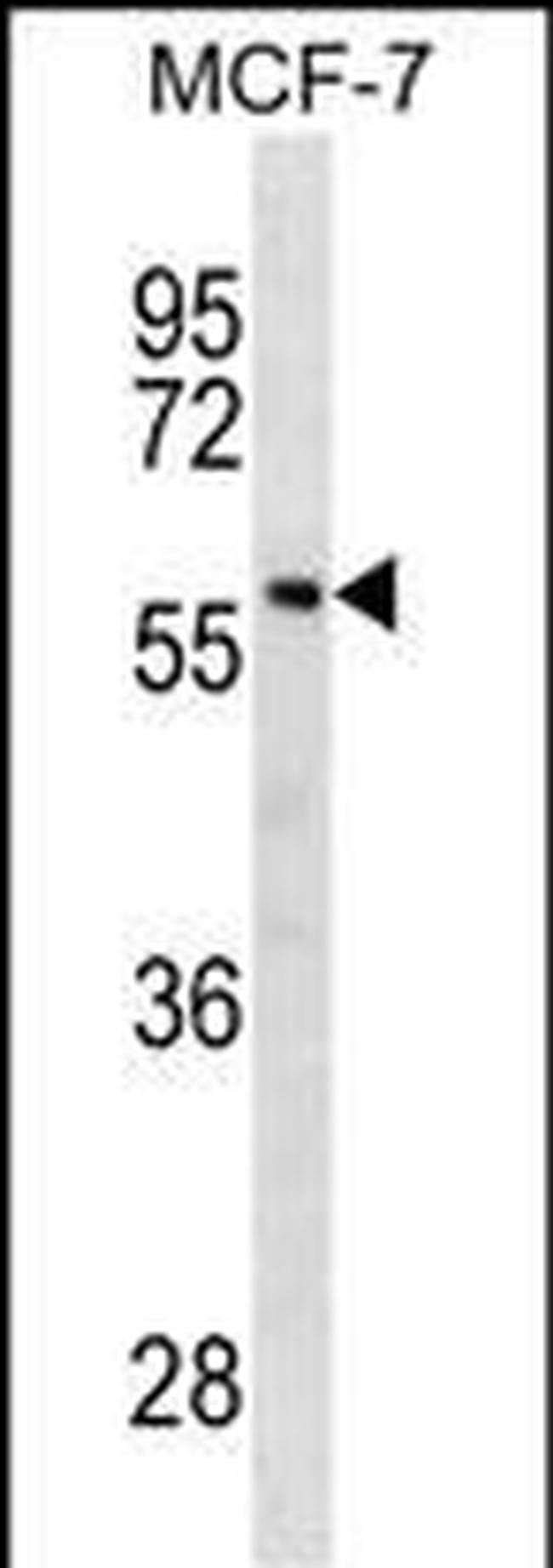 GBA Antibody in Western Blot (WB)