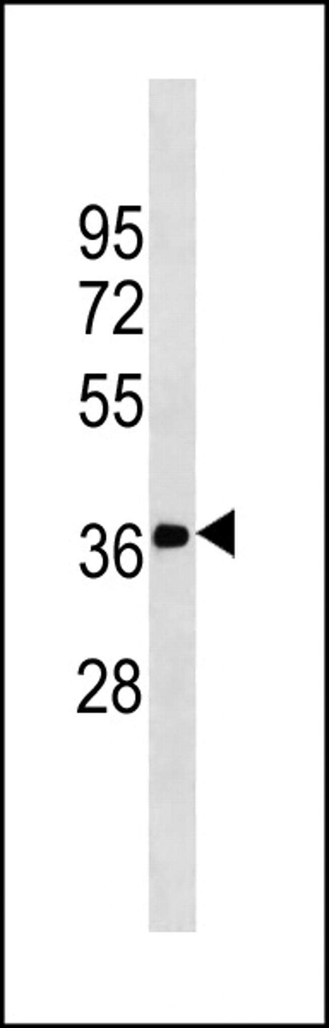 FN3K Antibody in Western Blot (WB)