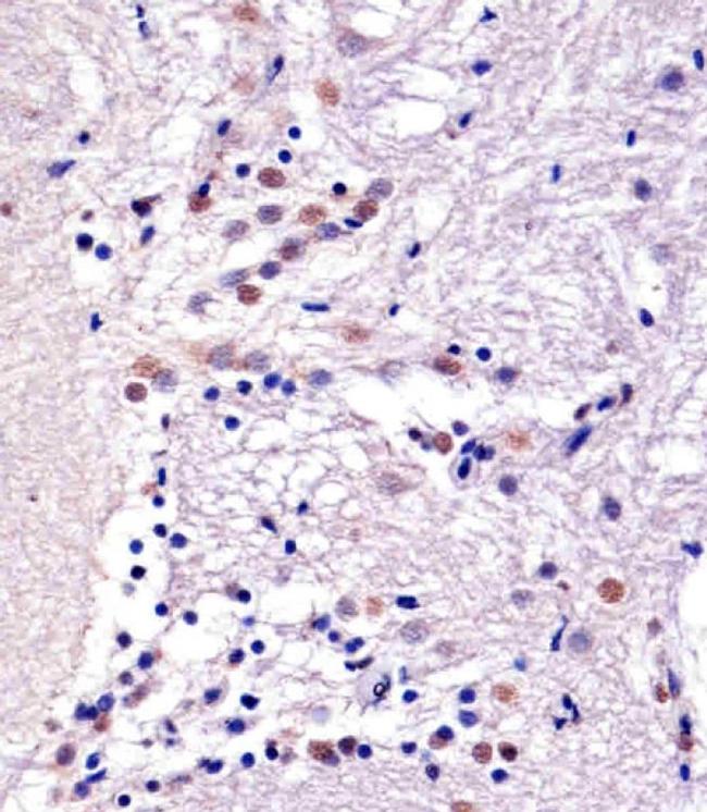 YY1 Antibody in Immunohistochemistry (Paraffin) (IHC (P))