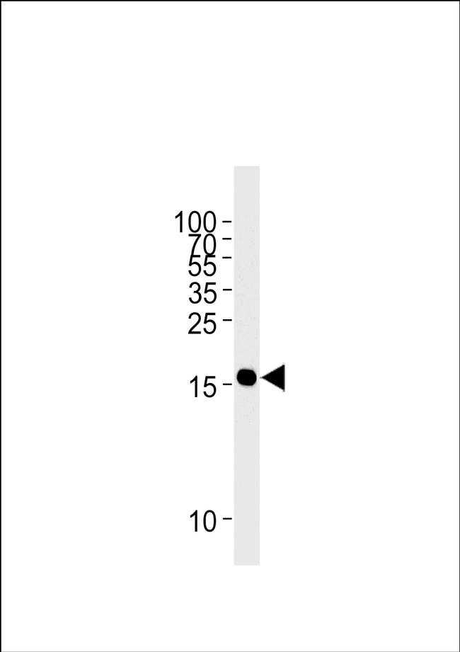 GMFG Antibody in Western Blot (WB)