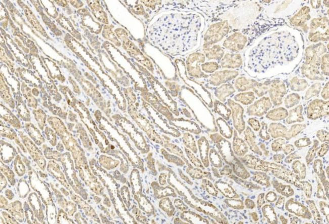 BBS4 Antibody in Immunohistochemistry (Paraffin) (IHC (P))