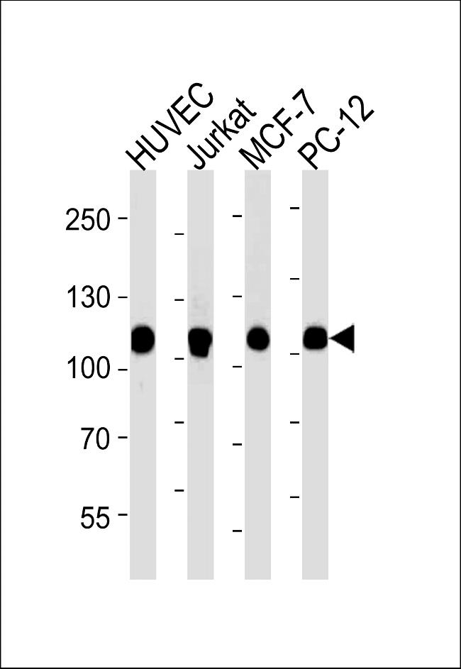 TOP1 Antibody in Western Blot (WB)