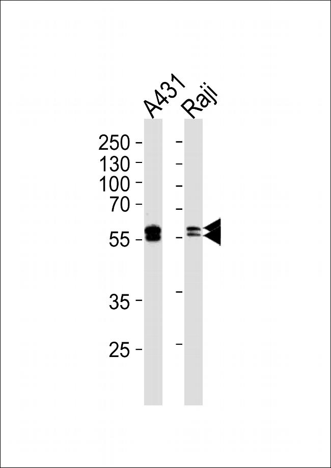 Lyn Antibody in Western Blot (WB)