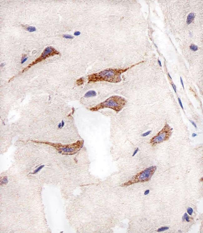 Aurora A Antibody in Immunohistochemistry (Paraffin) (IHC (P))