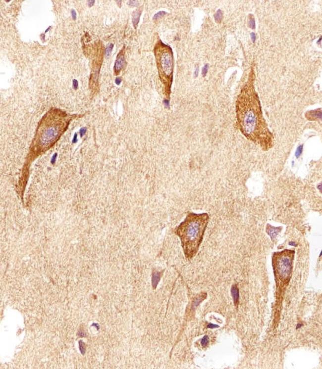 VAMP8 Antibody in Immunohistochemistry (Paraffin) (IHC (P))