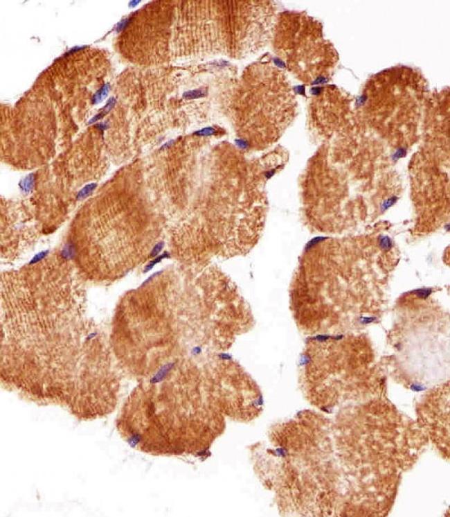 ATG3 Antibody in Immunohistochemistry (Paraffin) (IHC (P))