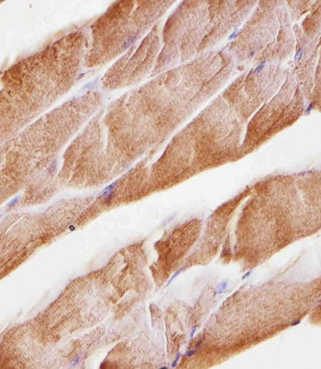 MUSK Antibody in Immunohistochemistry (Paraffin) (IHC (P))