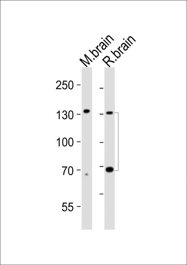 TrkC Antibody in Western Blot (WB)