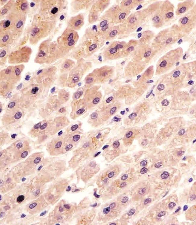 FER Antibody in Immunohistochemistry (Paraffin) (IHC (P))