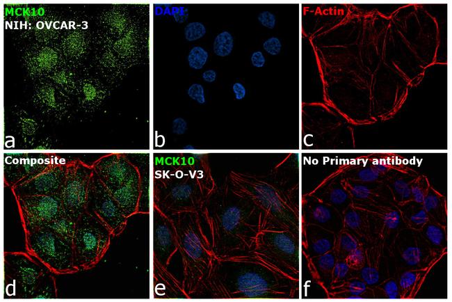 MCK10 Antibody in Immunocytochemistry (ICC/IF)