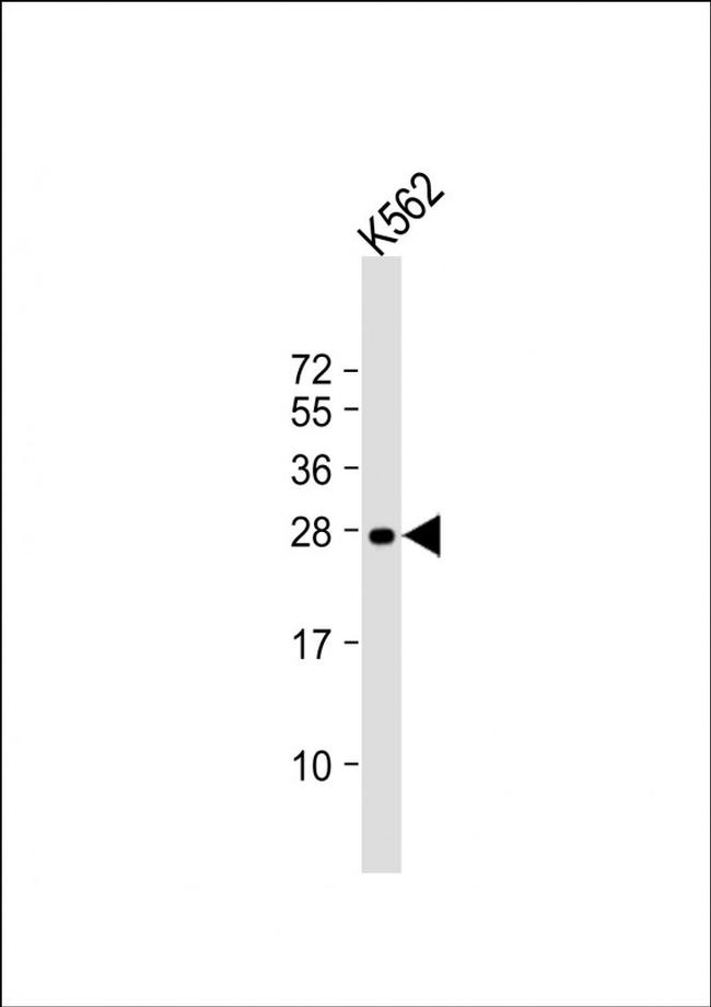 RAB27A Antibody in Western Blot (WB)