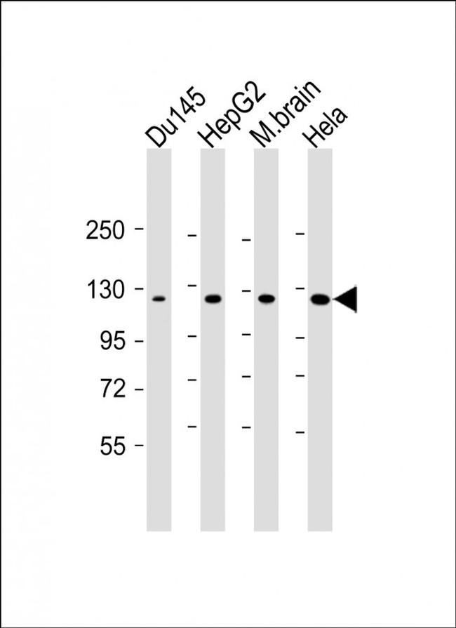 DAB2IP Antibody in Western Blot (WB)