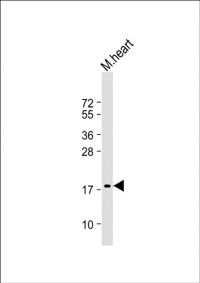 ANP Antibody in Western Blot (WB)