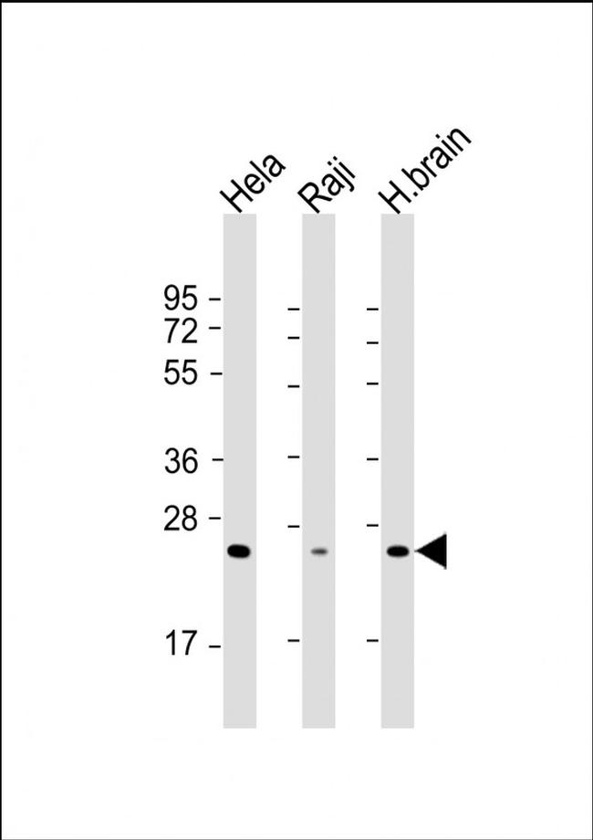 RAB14 Antibody in Western Blot (WB)