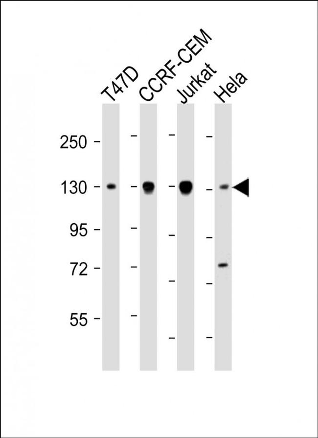 DNMT3A Antibody in Western Blot (WB)