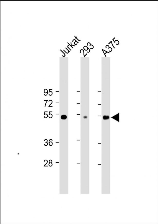 RBCK1 Antibody in Western Blot (WB)