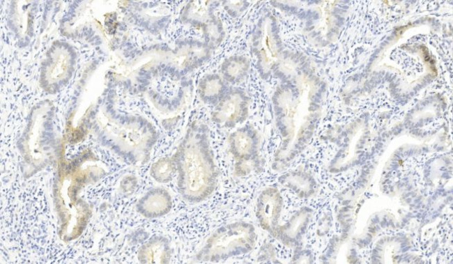 ROS1 Antibody in Immunohistochemistry (Paraffin) (IHC (P))