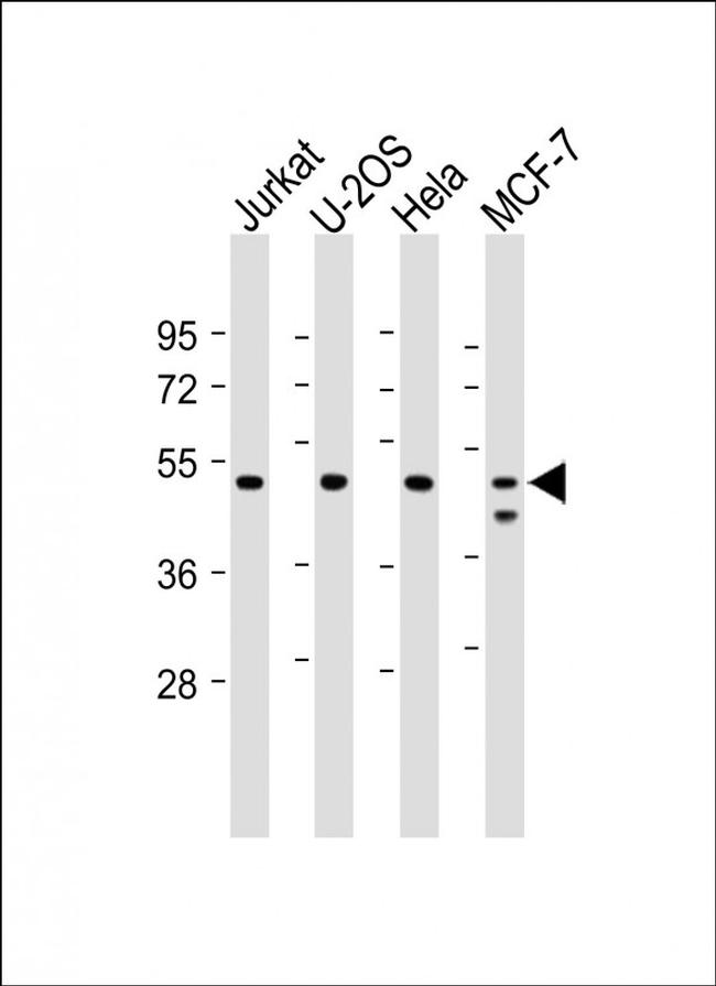 PSMC2 Antibody in Western Blot (WB)