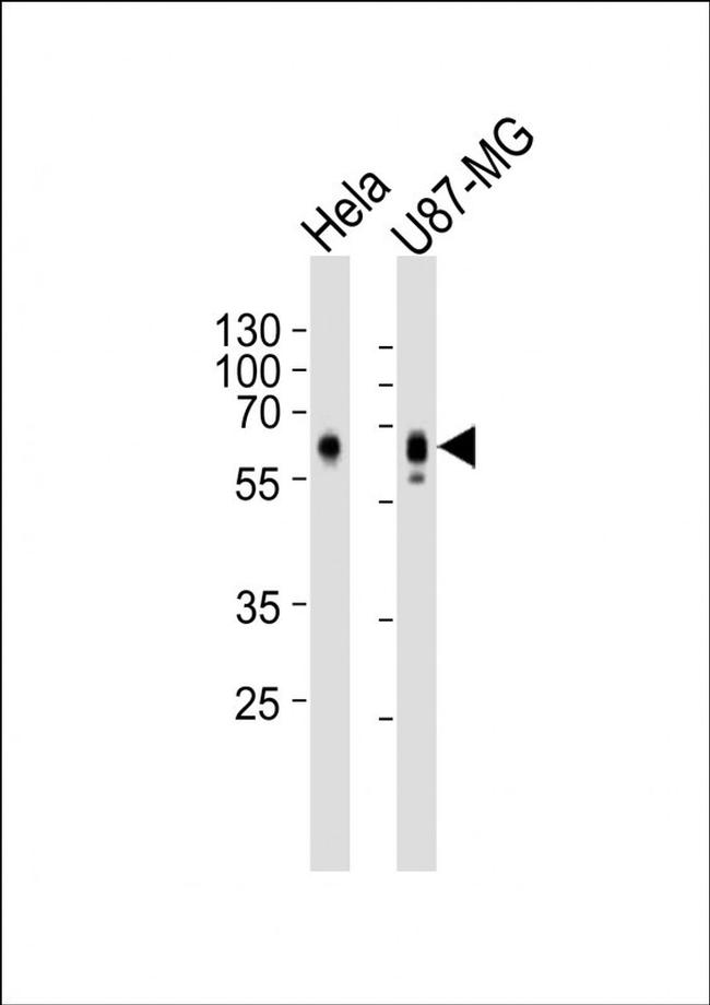 GPR56 Antibody in Western Blot (WB)