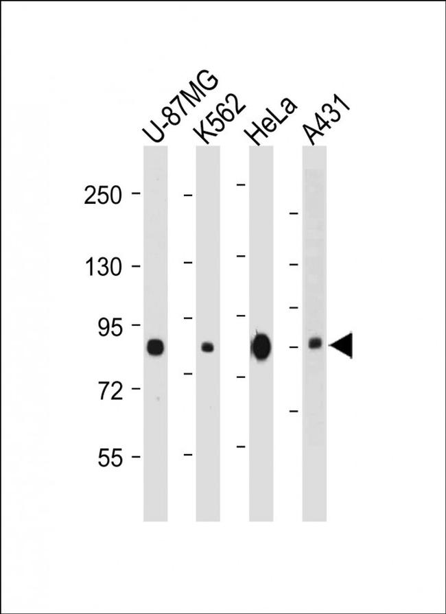 PLOD1 Antibody in Western Blot (WB)