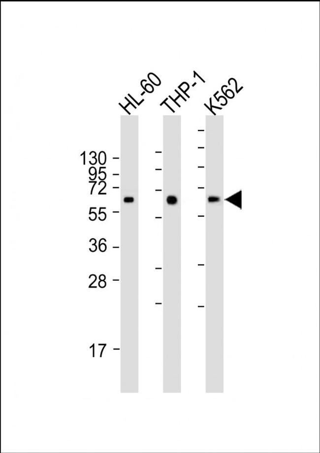 CARD9 Antibody in Western Blot (WB)