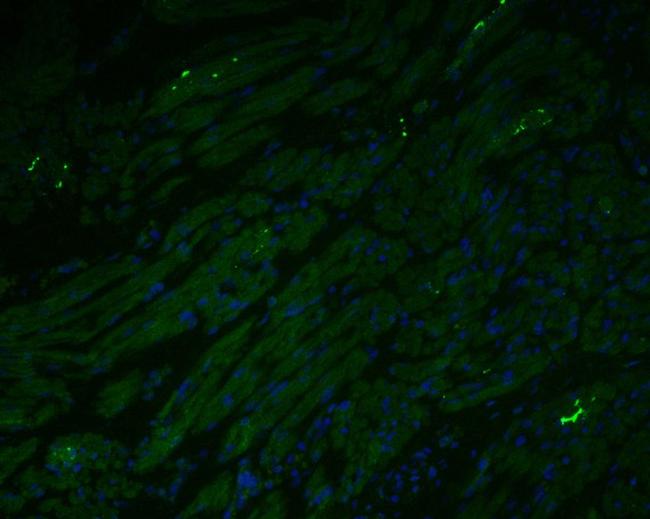 Myoglobin Antibody in Immunohistochemistry (Paraffin) (IHC (P))