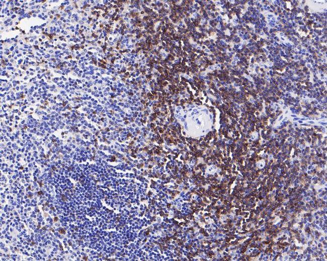 CD5 Antibody in Immunohistochemistry (Paraffin) (IHC (P))