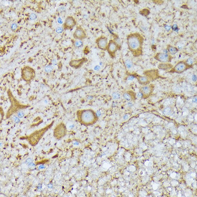 CaMKII Pan Antibody in Immunohistochemistry (Paraffin) (IHC (P))