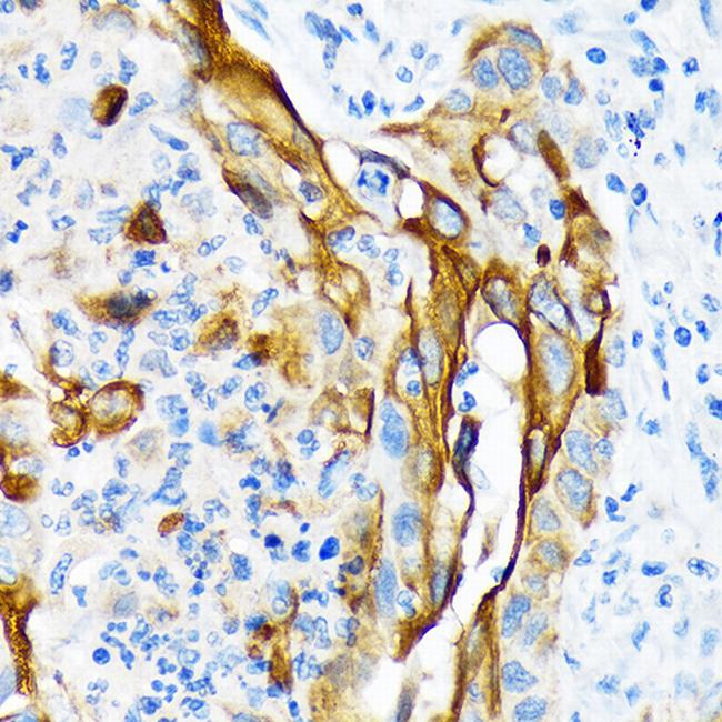 Cytokeratin 13 Antibody in Immunohistochemistry (Paraffin) (IHC (P))