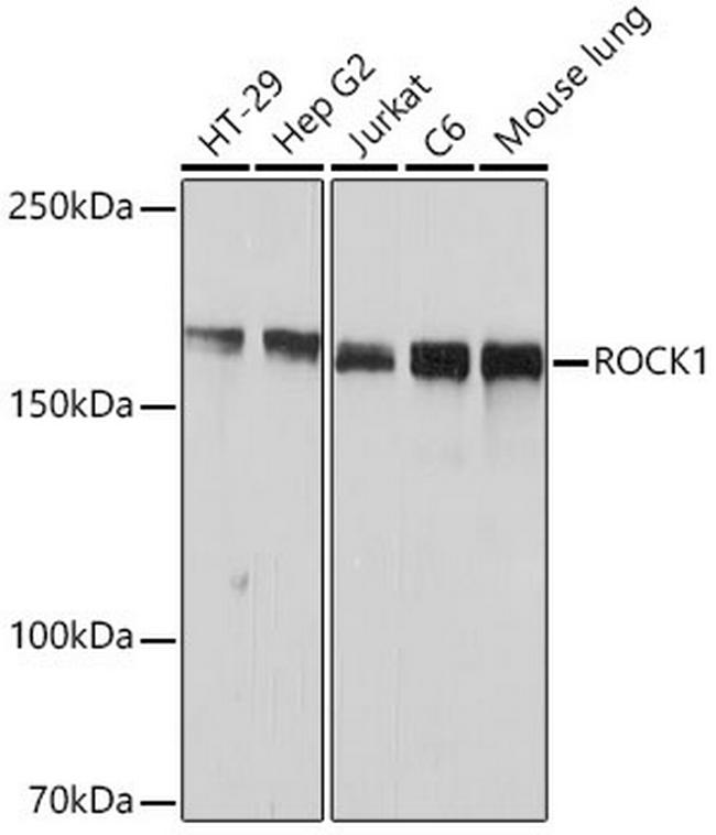 ROCK1 Antibody in Western Blot (WB)