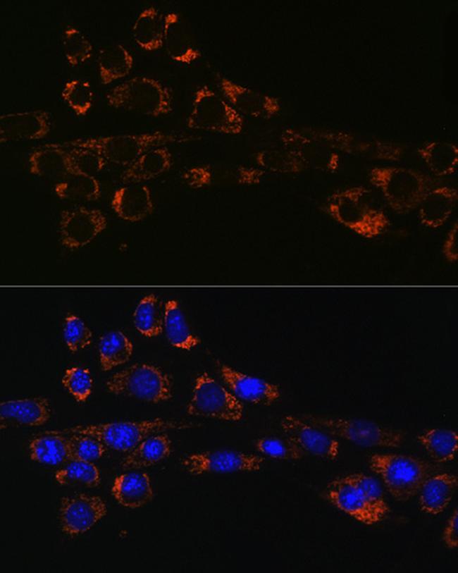 SERPINH1 Antibody in Immunocytochemistry (ICC/IF)