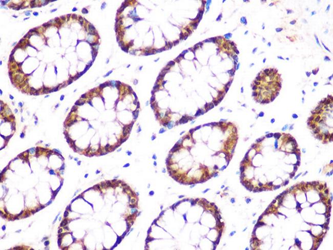 UCHL3 Antibody in Immunohistochemistry (Paraffin) (IHC (P))