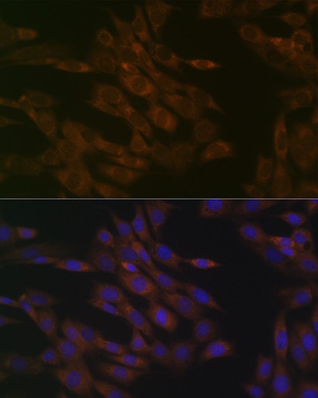 TIMM50 Antibody in Immunocytochemistry (ICC/IF)