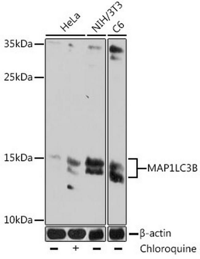 LC3B Antibody in Western Blot (WB)