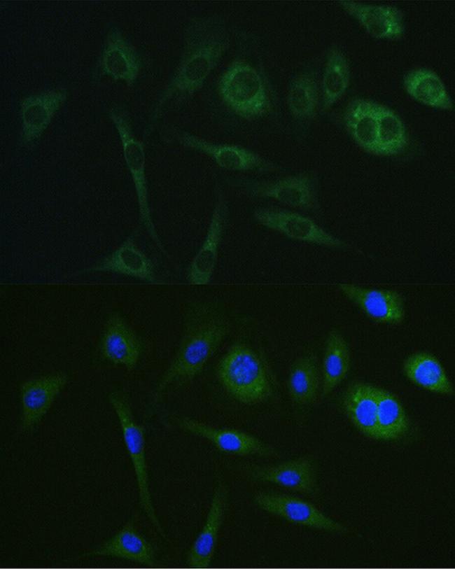 PKA alpha Antibody in Immunocytochemistry (ICC/IF)