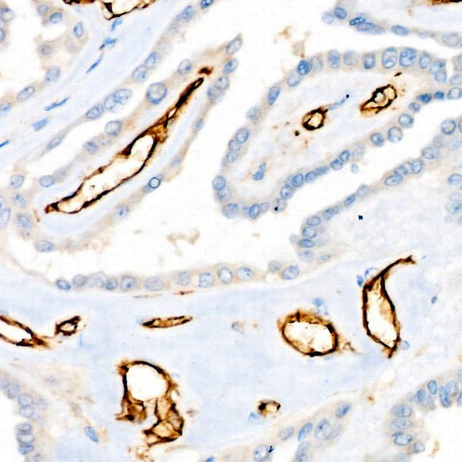 CD31 (PECAM-1) Antibody in Immunohistochemistry (Paraffin) (IHC (P))