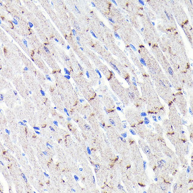 N-cadherin Antibody in Immunohistochemistry (Paraffin) (IHC (P))